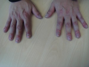 ネイルケア写真